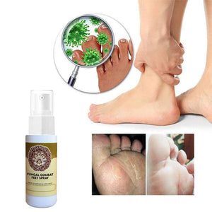 Foot Deodorant and Dehumidification Spray